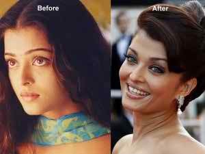 aishwarya-rai-before-after-surgery-pics ঐশ্বরিয়া রাই